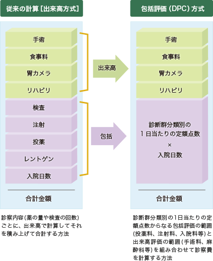 DPCについて